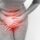What Causes Chronic Pelvic Pain in Women?